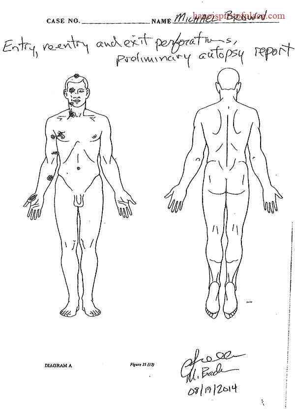 Autopsy Report Findings