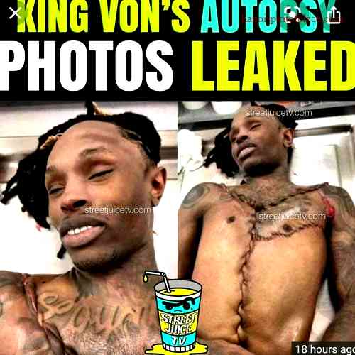 Unveiling the Truth Behind King Von Autopsy Death