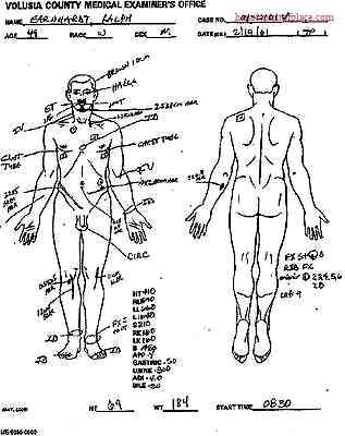 Dale Earnhardt Autopsy Photos: Tragic Incident Revealed