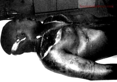 The Autopsy Photo and Its Release