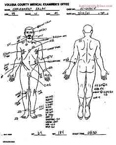 Dale Earnhardt Autopsy Report: Shedding Light on the Truth