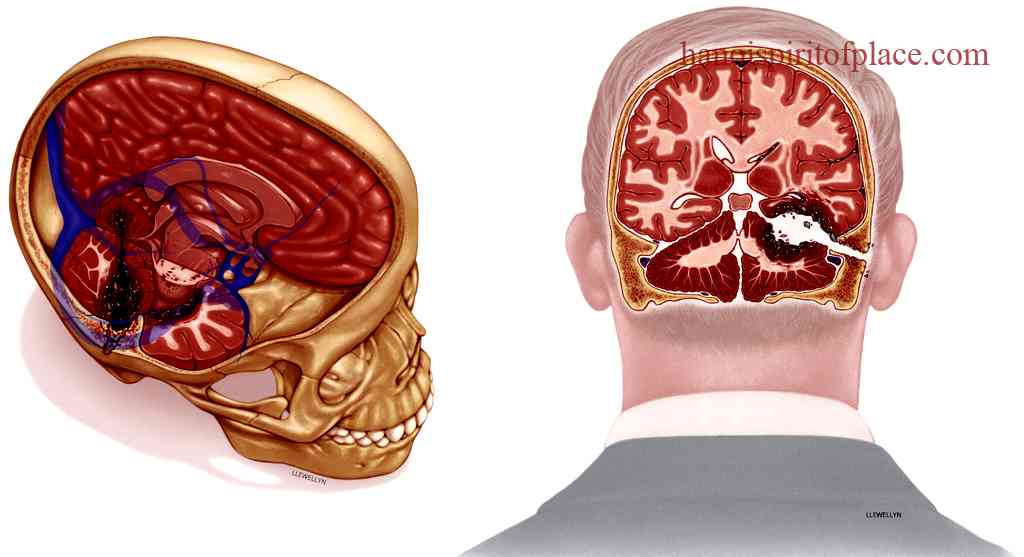 Unanswered Questions Surrounding the JFK Autopsy Brain