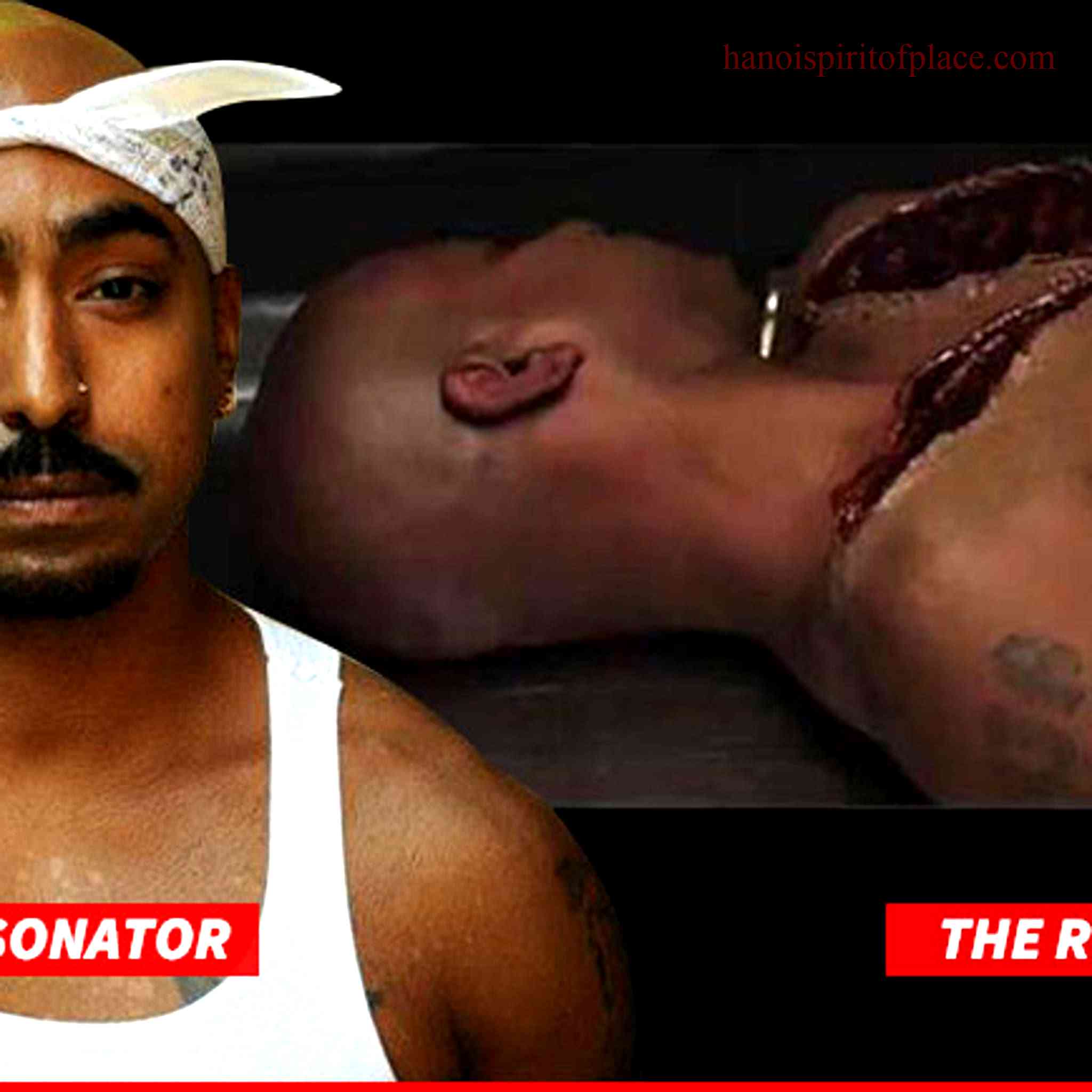 Unveiling the Intriguing Tupac Autopsy Photos