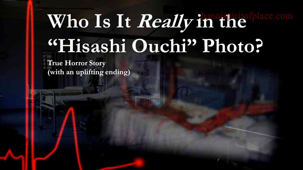 Hisashi Ouchi Real Photos Hospital: Unveiling a Tragic Medical Case