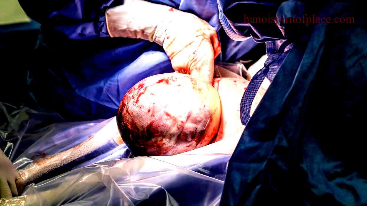 Exploring the Amniotic Sac