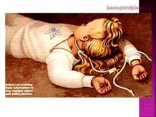 Exploring Jon Benet Ramsey Autopsy Photos and Intriguing Forensic Details